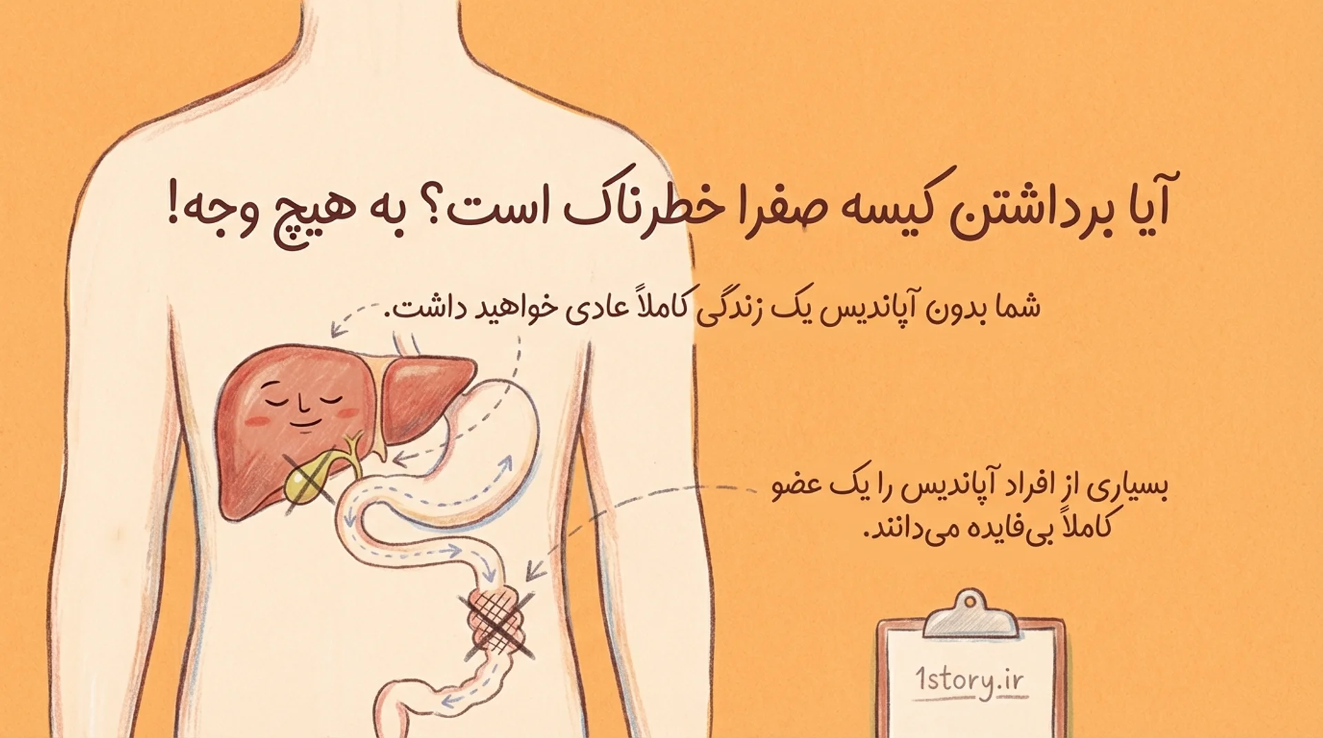 عکس آپاندیس و کیسه صفرا